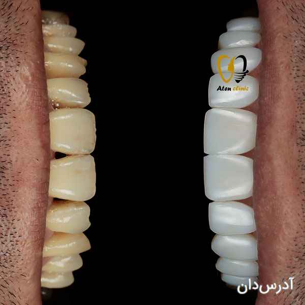 کلینیک دندانپزشکی و زیبایی آتن