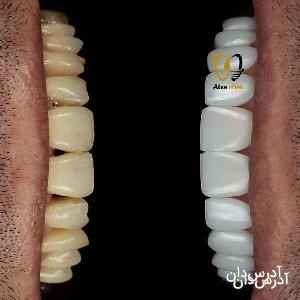 آدرس دان - کلینیک دندانپزشکی و زیبایی آتن